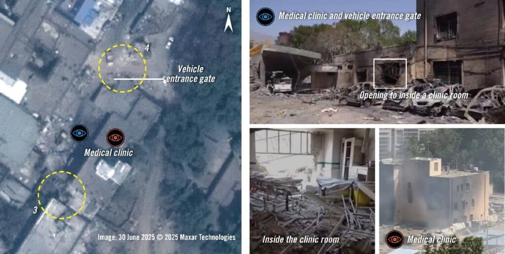 Teerão Irão Imagens de satélite (à esquerda) de 30 de junho de 2025 revelam dois locais (indicados com círculos amarelos) onde provavelmente caíram munições. Fotos e vídeos geolocalizados (à direita) mostram que o portão de entrada dos veículos ruiu. O interior da clínica ficou significativamente danificado, com paredes e janelas destruídas, enquanto o exterior apresenta graves danos causados pelo fogo e fumo.